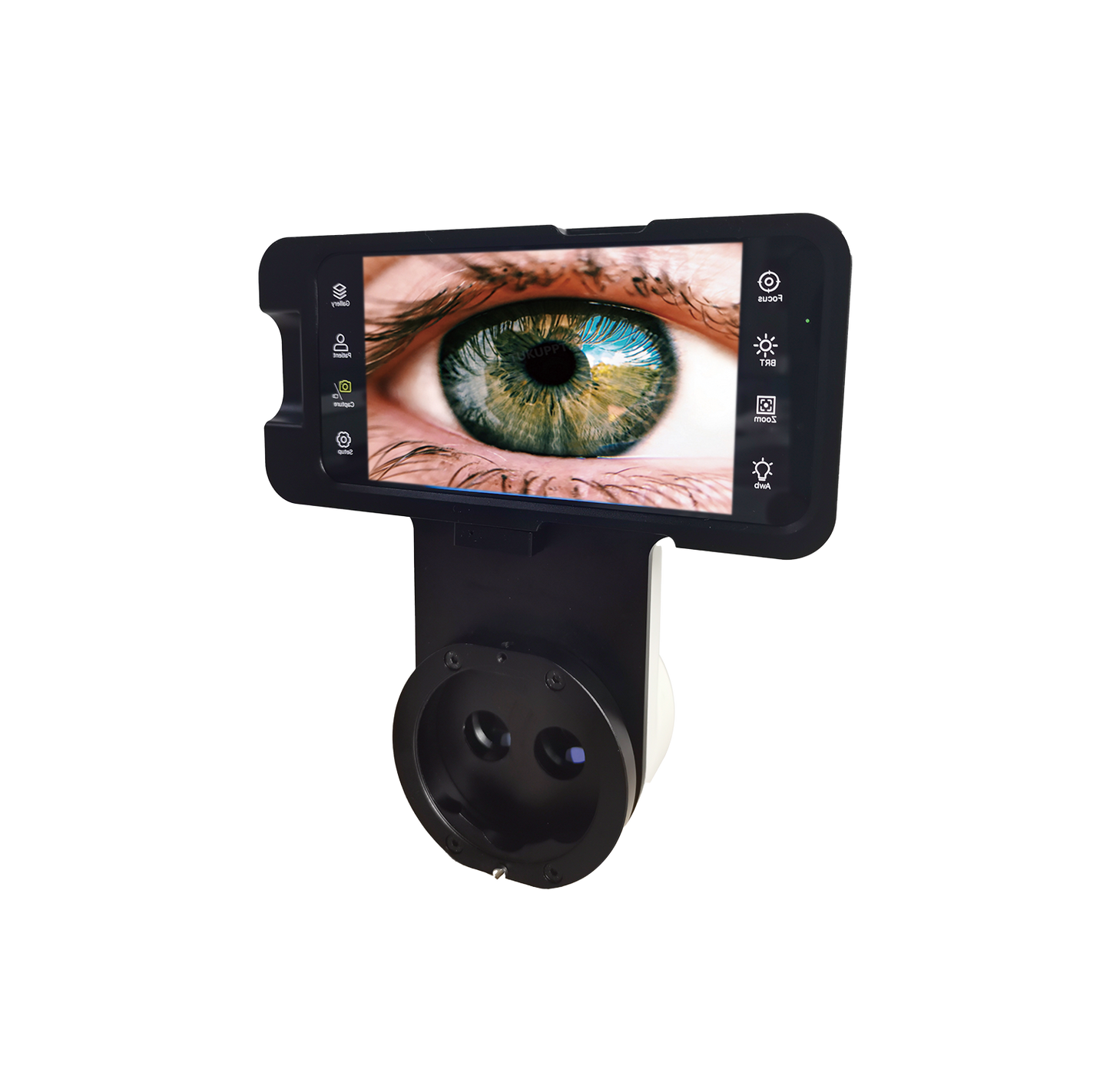 AIO Digital Slit Lamp Imaging System
