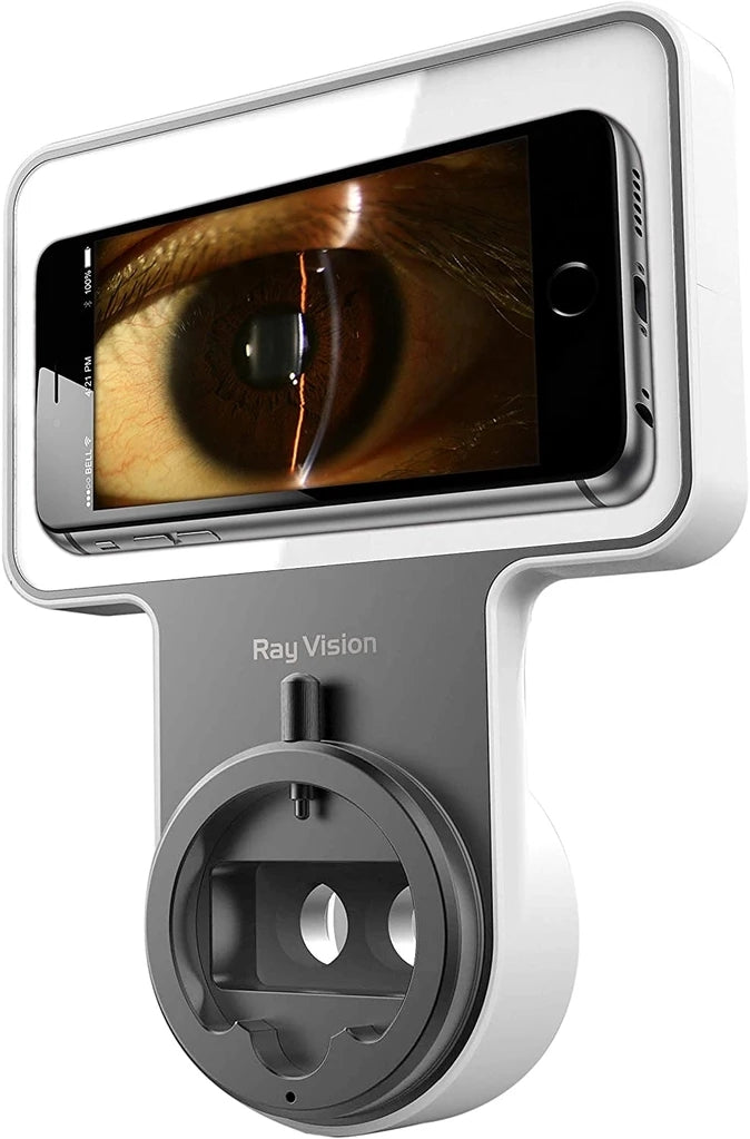 Phonto Digital Slit Lamp Imaging System Adaptor