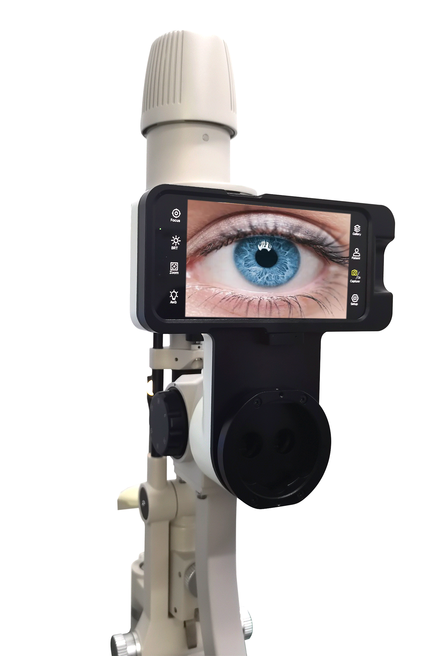 AIO Digital Slit Lamp Imaging System