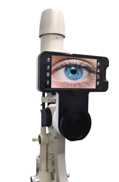 AIO Digital Slit Lamp Imaging System